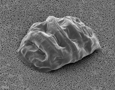 SEM of a tardigrade in anhydrobiosis (Source: http://knol.google.com/k/tardigrades#)
